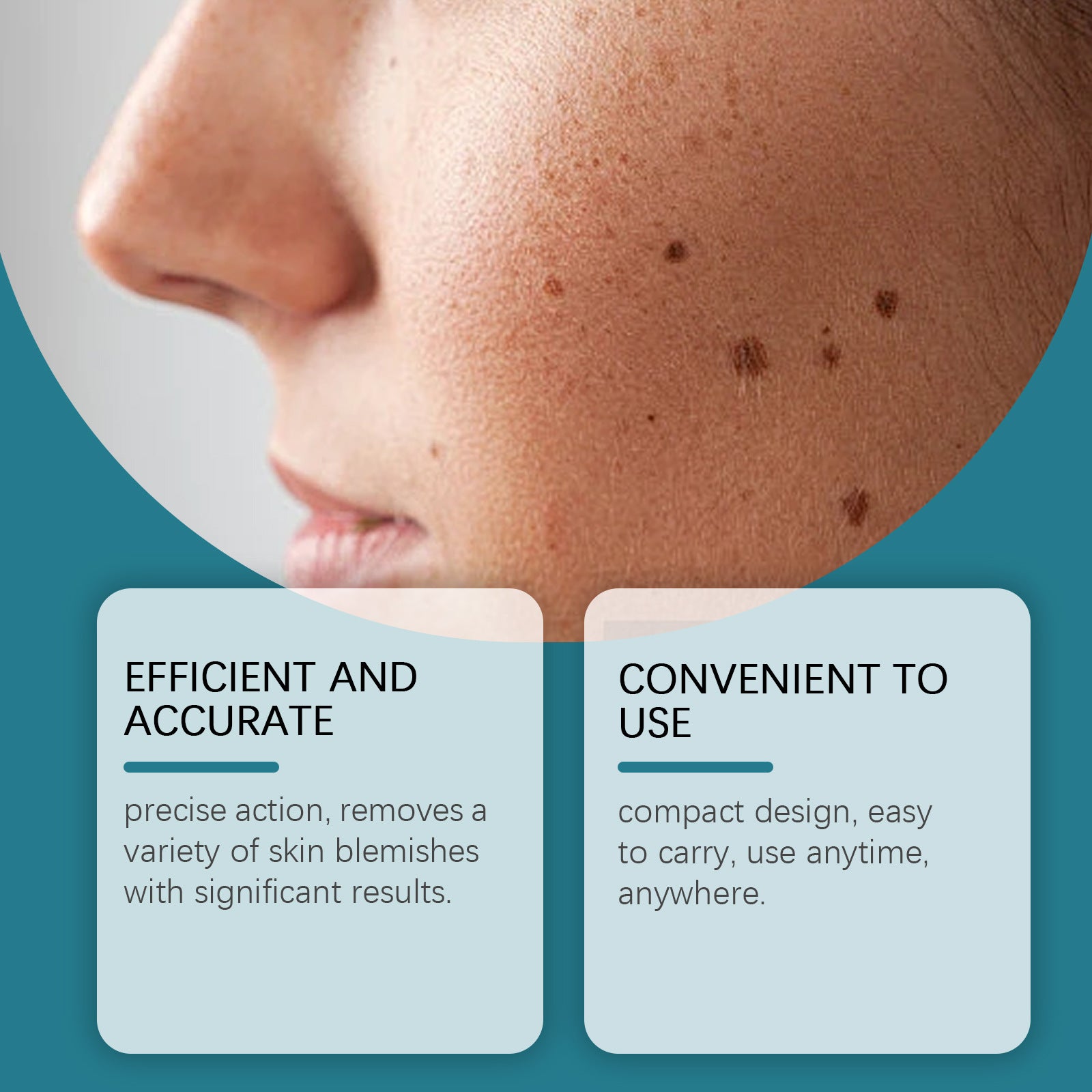 Skin Care Laser Pen
