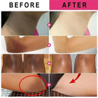 Whitening Cream For Dark Skin Underarm Bleaching Armpit Lightening And Intimate Area Woman Moisturizer Korean Skin Care Products
