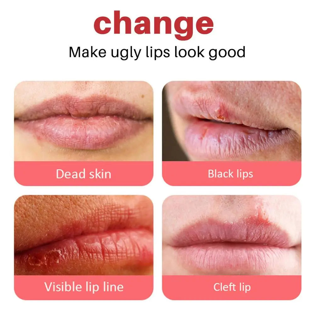 Remove Dark Lip Lip Balm Moisturizing Lightening Melanin Whitening Plumper Extreme Gloss Pink Lips Skin Care For Men Women